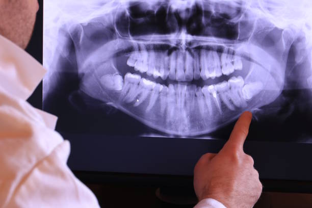 Best Emergency Tooth Extraction in Weddington, NC